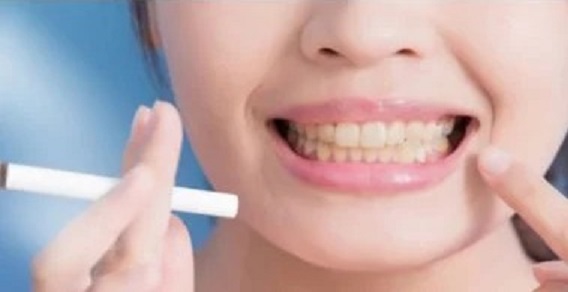 Heated Tobacco Aerosol vs. Cigarette Smoke: Lower Oral Health Risks Revealed